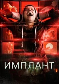 Имплант (2021)